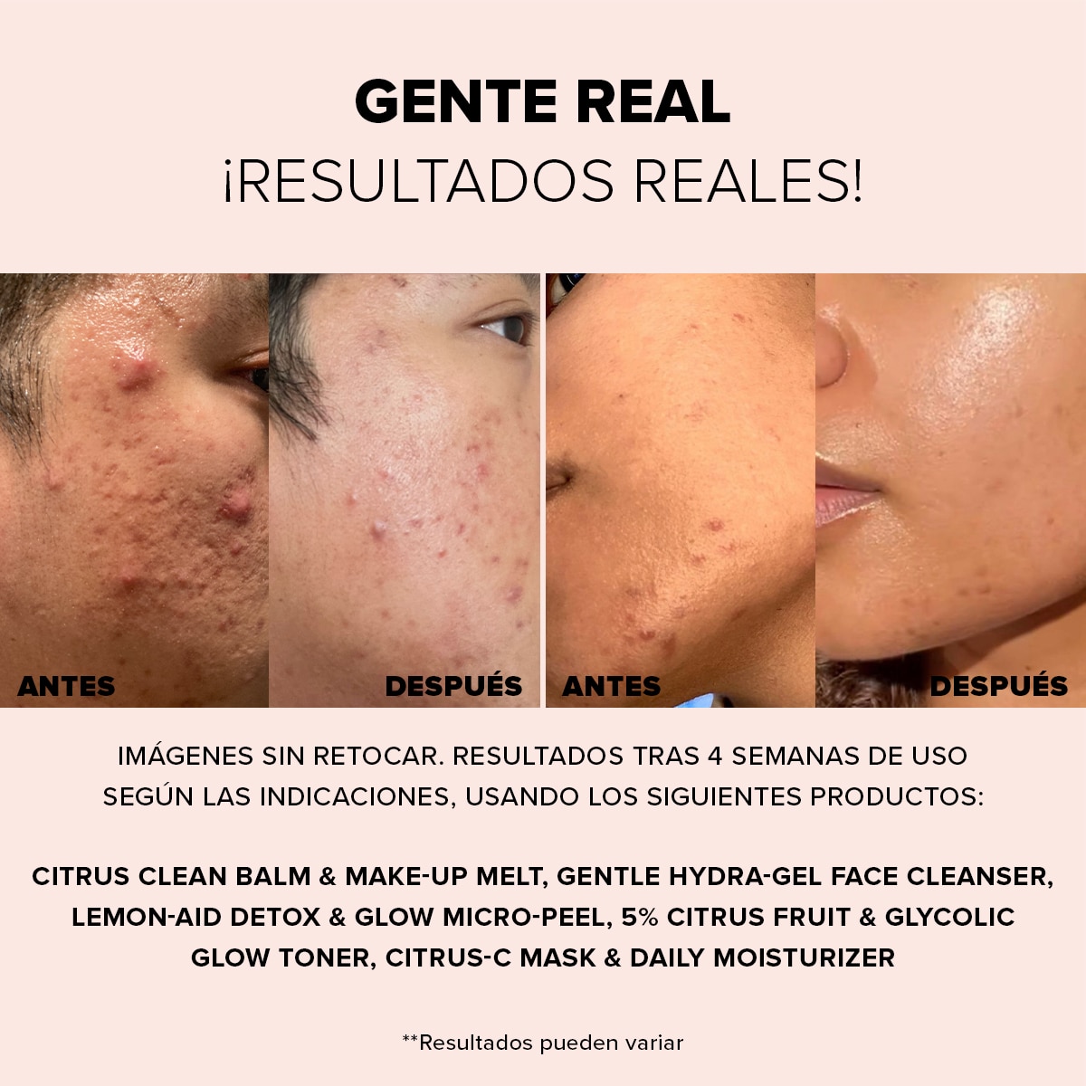 NUDESKIN LEMON-AID DETOX & GLOW MICRO-PEEL (EXFOLIANTE FACIAL)
